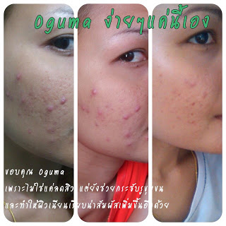 OGUMA สุดยอดสเปรย์น้ำแร่ตัวเทพ เพื่อผิวหน้าใส เด้ง สุขภาพดี รูปที่ 2