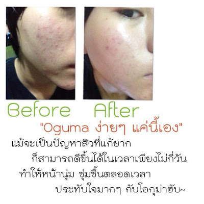 OGUMA สุดยอดสเปรย์น้ำแร่ตัวเทพ เพื่อผิวหน้าใส เด้ง สุขภาพดี รูปที่ 3