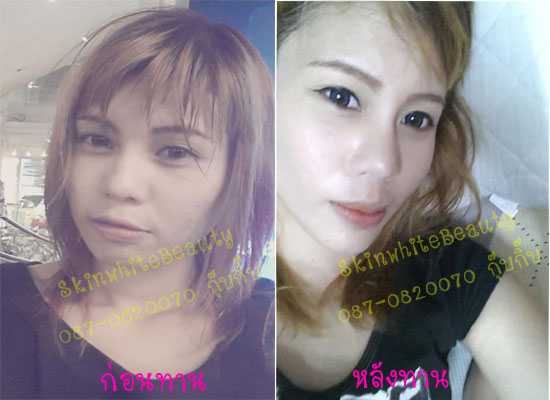 กลูต้าราคาส่ง ครีมโสม สลิปปิ้งมาร์ค ขาวจริงใน 7 วัน รูปที่ 1