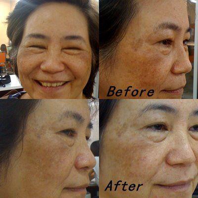 รูปย่อ Kalos Scoria Soap Healthy strong skin ช่วยย้อนกลับหน้าพังหลังสงกรานต์ให้สวยเหมือนเดิม รูปที่6