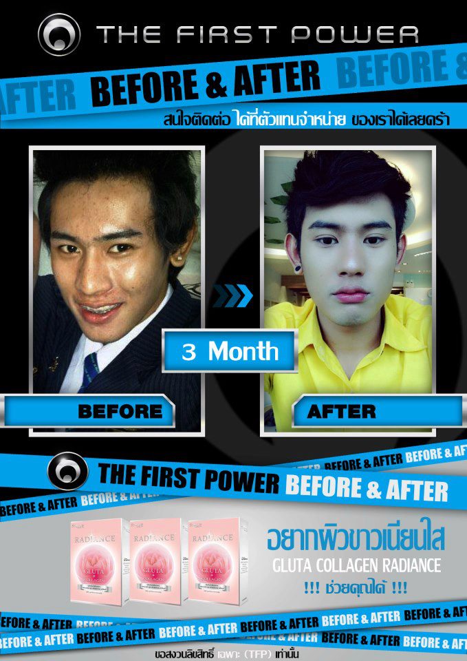 กลูต้า คอลลาเจนเรเดียนซ์ รูปที่ 5
