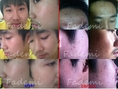 ขายส่ง FADEMI ผลิตภัณฑ์ที่ใช้แล้วเห็นผลจริงทุกตัว ครีมหน้าขาว รักษาสิว