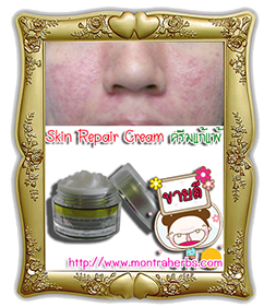 Skin Repair Cream ครีมบรรเทาอาการผื่นแพ้  รูปที่ 1