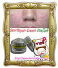 Skin Repair Cream ครีมบรรเทาอาการผื่นแพ้ 