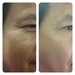 รูปย่อ Jeunesse รักษาสิวฝ้ากระ !รอยเหี่ยวย่น หายแบบน่าเหลือเชื่อ ประสิทธิภาพเทียบการฉีดใช้เงินหลังแสนหลักล้าน รูปที่6