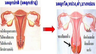 ไท้ผิง รูปที่ 3