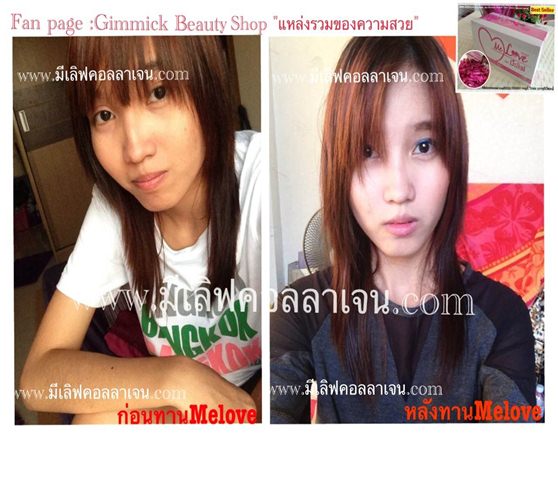 อยากผิวขาวกระจ่างใสอยากผอมเพรียวกับMeLOvEกับ Meshielvingขาว100% รูปที่ 1