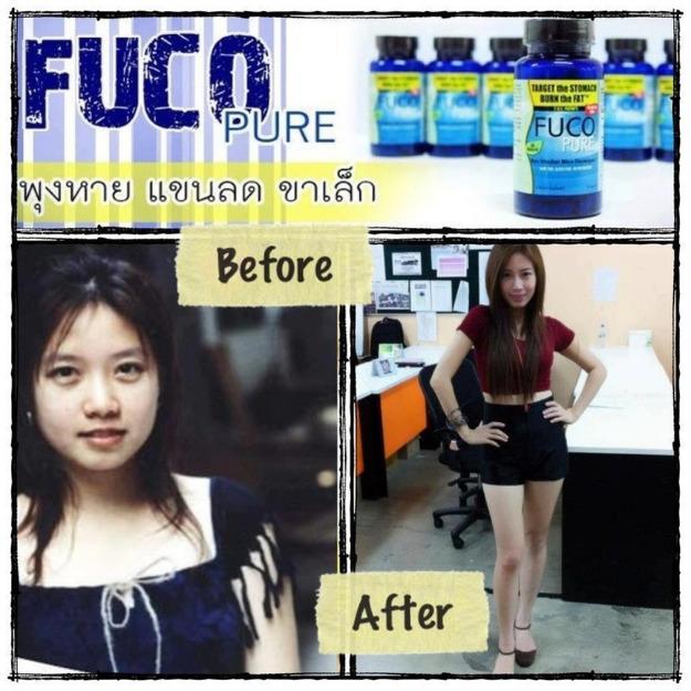 Fuco Pure พุงยุบ แขนลด ขาเล็ก ปลอดภัย ไม่โยโย่ รูปที่ 1