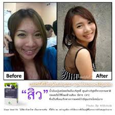 สารสกัดเมล็ดองุ่นแบบสกัดเย็น  รูปที่ 4