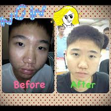 สารสกัดเมล็ดองุ่นแบบสกัดเย็น  รูปที่ 5