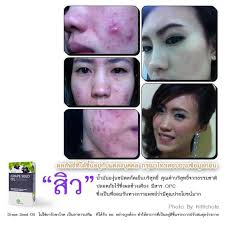 Grape Seed Oil น้ำมันสกัดจากเม็ดองุ่น รูปที่ 1