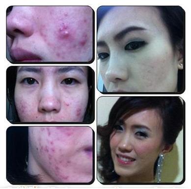 Grape  Seed Oil น้ำมันสกัดจากเมล็ดองุ่น รูปที่ 2