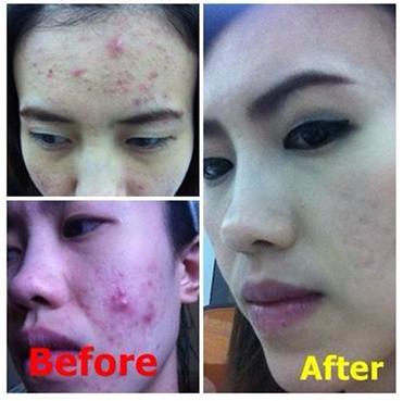 Grape  Seed Oil น้ำมันสกัดจากเมล็ดองุ่น รูปที่ 3