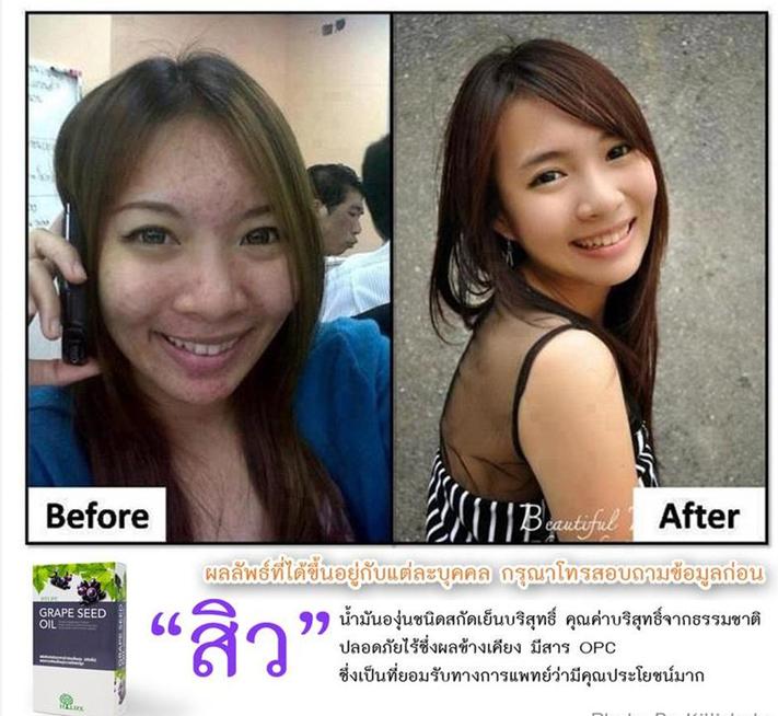 Grape  Seed Oil น้ำมันสกัดจากเมล็ดองุ่น รูปที่ 4