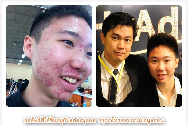 Grape  Seed Oil น้ำมันสกัดจากเมล็ดองุ่น รูปที่ 5