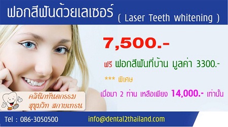 คลินิกทันตกรรมสุขุมวิท รับปรึกษาให้กับผู้ที่สนใจฟอกฟันขาว รูปที่ 1