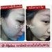 รูปย่อ ดีเท็นพลัสคอลลาเจน D-10 Plus Collagen    รูปที่4