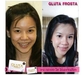 รูปย่อ เปิดหาร glutafrosta ของแท้ 100% รับประกัน รูปที่6