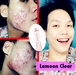 รูปย่อ Lamoon Clear ละมุนเคลียร์ กำจัดสิวทุกชนิด รูปที่3