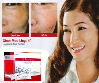 คลอลาเจนแก้ปัญหาสิวฝ้า รอยตีนกา ไม่ต้องเจ็บตัว รูปที่ 7