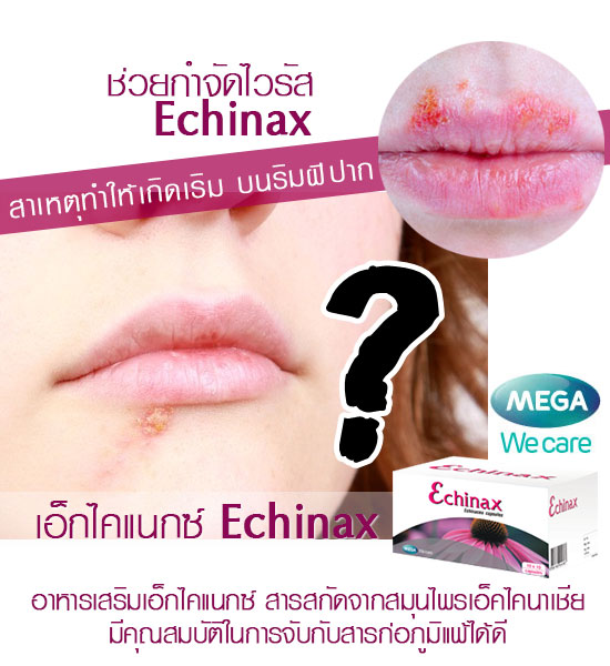 ECHINAX เป็นเริม นอนดึก และต้องดื่มเหล้า สมุนไพรเอ็คไคนาเชีย ช่วยฆ่าไวรัส รูปที่ 1
