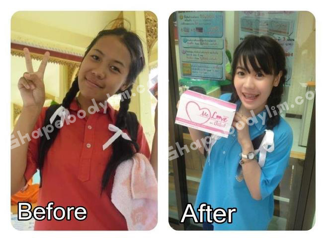 Melove collagen 8000mg. ขาวใสใน 7 วัน ไม่เห็นผลยินดีคืนเงิน รูปที่ 6