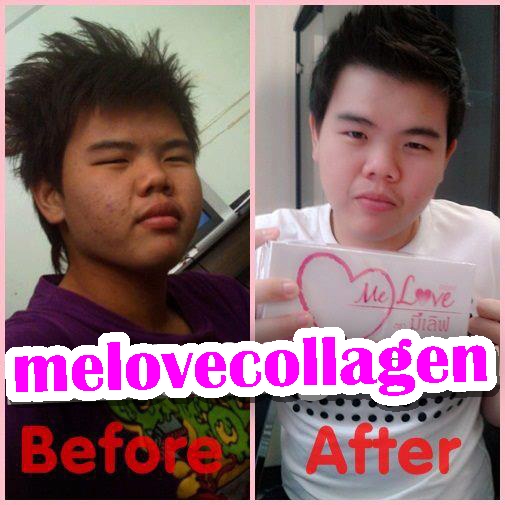 Melove collagen 8000mg. ขาวใสใน 7 วัน ไม่เห็นผลยินดีคืนเงิน รูปที่ 5