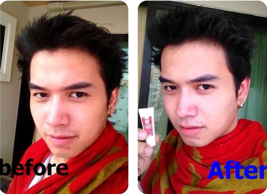 หน้าขาวเนียนใส รูปที่ 5
