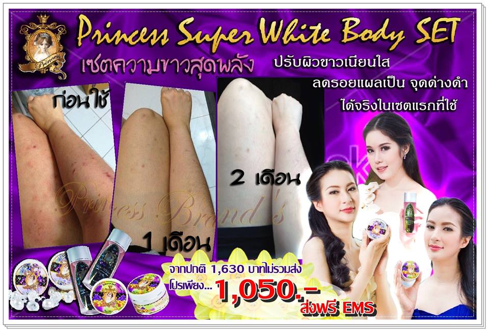 ขาลาย ตัวดำ ผิวแย่ Princess Set ช่วยคุณได้จริง ขาวเนียนใสแบบสุดๆ  เห็นผลจริงในเซตแรกมี อย.ปลอดภัย รูปที่ 1