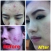 รูปย่อ Grape  Seed Oil  ผิวขาว ความดัน โรคหัวใจ น้ำมันสะกัดจากองุ่น 100% รูปที่2