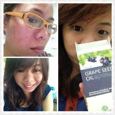 Grape  Seed Oil  ผิวขาว ความดัน โรคหัวใจ น้ำมันสะกัดจากองุ่น 100% รูปที่ 1