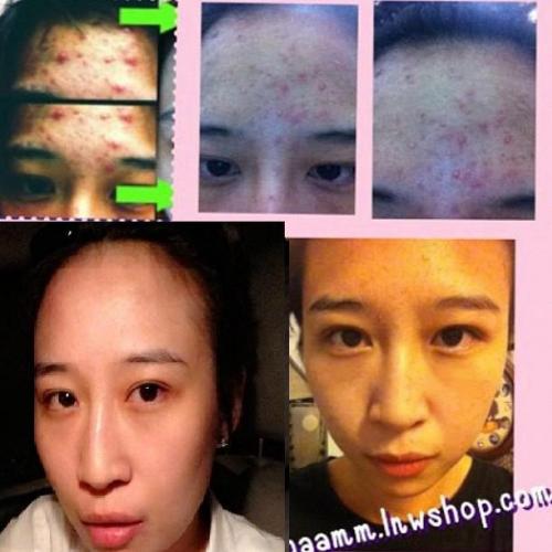 ผลิตภัณฑ์อาหารเสริม ลดสัดส่วน พุ้ง แขน ขา ลดสัดส่วน 100% รูปที่ 7