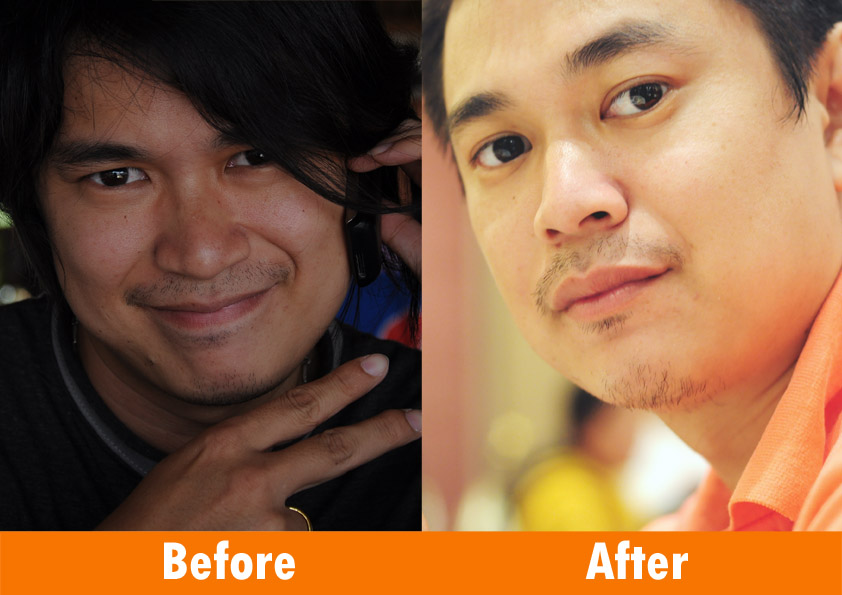 ผลิตภัณฑ์อาหารเสริม ลดสัดส่วน พุ้ง แขน ขา ลดสัดส่วน 100% รูปที่ 4