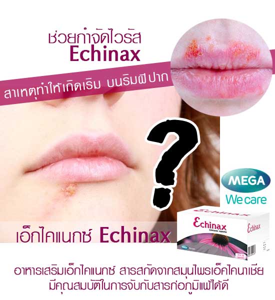 ECHINAX เป็นเริม นอนดึก และต้องดื่มเหล้า สมุนไพรเอ็คไคนาเชีย ช่วยฆ่าไวรัส  55 รูปที่ 1