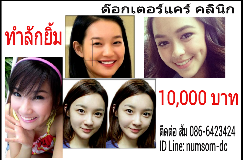 ทำลักยิ้ม ด๊อกเตอร์แคร์ ขอนแก่นติดต่อ ส้ม086-6423424 รูปที่ 1