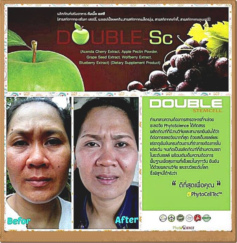 งานรายได้พิเศษ สมัครฟรี ไม่เสียเงิน เริ่มทำได้เลย ได้ค่าแนะนำ 500 บาท กับได้ 5,000 บาท ต่อ1ราย ได้ทันทีในวันรุ่งขึ้น แค่แนะนำให้คนซื้ออาหารเสริมสเต็ รูปที่ 7