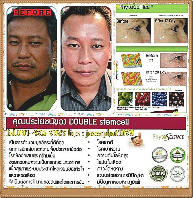 งานรายได้พิเศษ สมัครฟรี ไม่เสียเงิน เริ่มทำได้เลย ได้ค่าแนะนำ 500 บาท กับได้ 5,000 บาท ต่อ1ราย ได้ทันทีในวันรุ่งขึ้น แค่แนะนำให้คนซื้ออาหารเสริมสเต็ รูปที่ 6