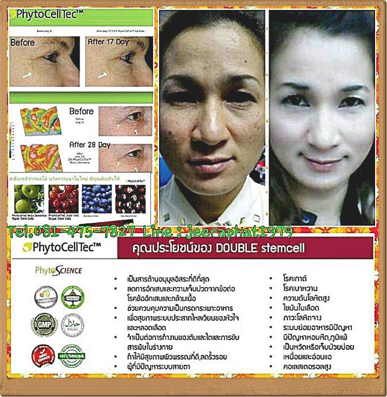 งานรายได้พิเศษ สมัครฟรี ไม่เสียเงิน เริ่มทำได้เลย ได้ค่าแนะนำ 500 บาท กับได้ 5,000 บาท ต่อ1ราย ได้ทันทีในวันรุ่งขึ้น แค่แนะนำให้คนซื้ออาหารเสริมสเต็ รูปที่ 3