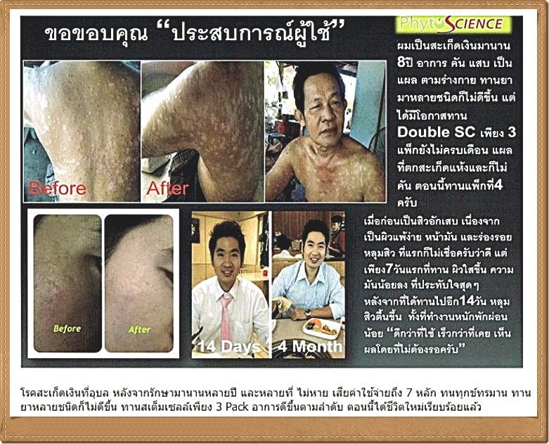 ที่สุดของการได้เงินเยอะ 1,500-19,000 บาท ต่อ 1 การแนะนำ ได้ทันทีในวันรุ่งขึ้น สุดยอดของอาหารเสริม คืนความเยาว์วัย แก้ปัญหาสุขภาพ กับสเต็มเซลล์แบบทานจากสวิส มีอย. รางวัลนวัตกรรม รูปที่ 7