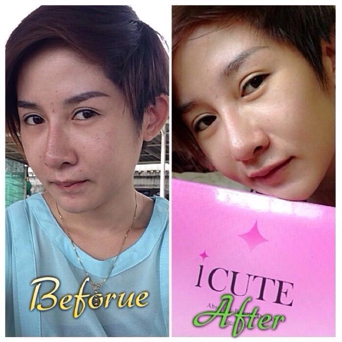 iCute Collagen ไอคิ้ว คอลลาเจน 20,000mg ขาว เด้ง กระจ่างใสใน 3 วัน รูปที่ 7