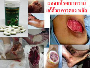 คาวตอง พลัส(Kowtong plus) รูปที่ 6