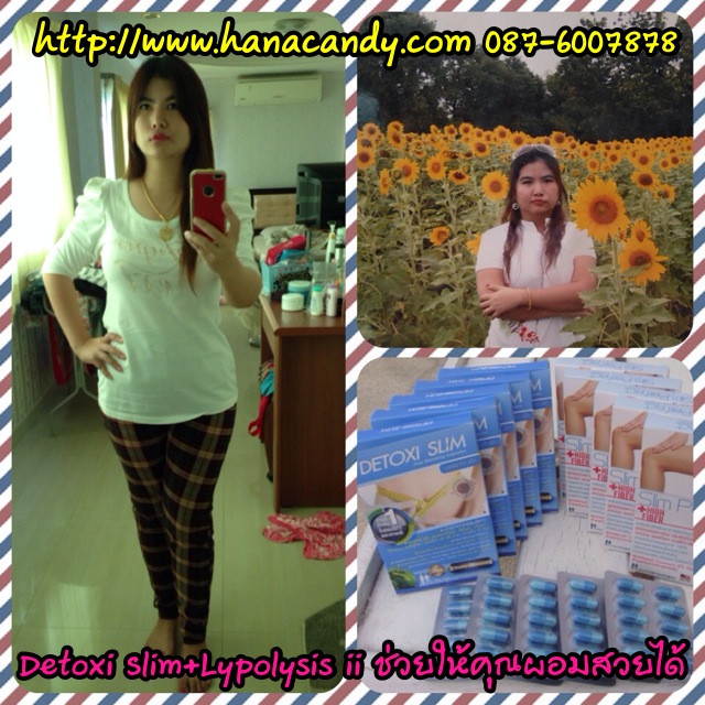 Lypolysis ii สมุนไพรสลายไขมันขายส่ง22-90฿ของแท้087-6007878 รูปที่ 5