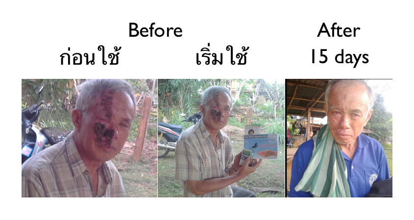 AIMMURA SESAMIN เอมมูร่าเซซามิน สารสกัดจากงาดำเพื่อสุขภาพ รูปที่ 6