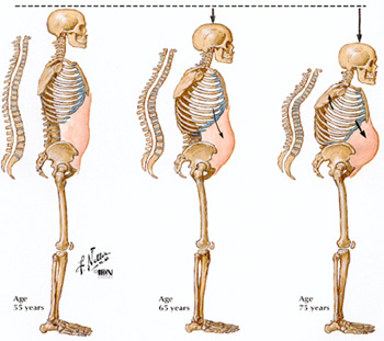 Calcium-D แคลเซียมเหลวดูดซึมดี ป้องกันกระดูกพรุน รูปที่ 3