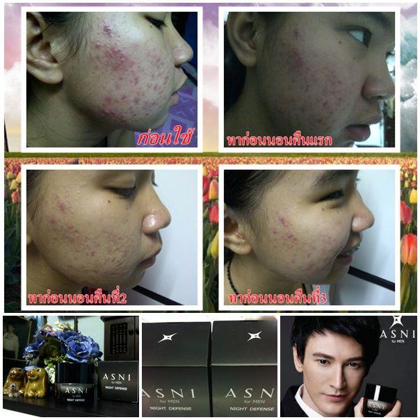 ASNI Night Defense for MEN ตัวนี้สุดยอด ใช้เทคโนโลยีใหม่ล่าสุดของโลกจากฝรั่งเศส รูปที่ 3