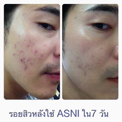 ASNI Night Defense for MEN ตัวนี้สุดยอด ใช้เทคโนโลยีใหม่ล่าสุดของโลกจากฝรั่งเศส รูปที่ 4