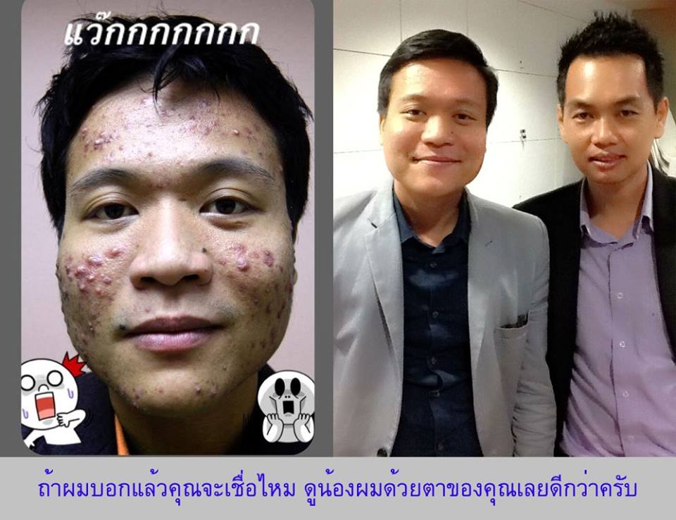 ASNI Night Defense for MEN ตัวนี้สุดยอด ใช้เทคโนโลยีใหม่ล่าสุดของโลกจากฝรั่งเศส รูปที่ 7