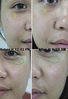 ASNI Night Defense for MEN ตัวนี้สุดยอด ใช้เทคโนโลยีใหม่ล่าสุดของโลกจากฝรั่งเศส รูปที่ 5