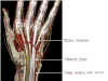 รูปย่อ ไลโปอิกแอซิด  ช่วยลดอาการชาปลายมือปลายเท้า ปลายประสาทเสื่อม รูปที่4