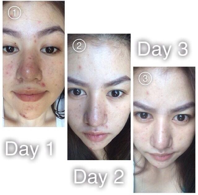 CHOUU Collagen,โชว คอลลาเจน,20,000mg ขาวเร่งด่วนใน7วัน การันตีเห็นผล รูปที่ 5